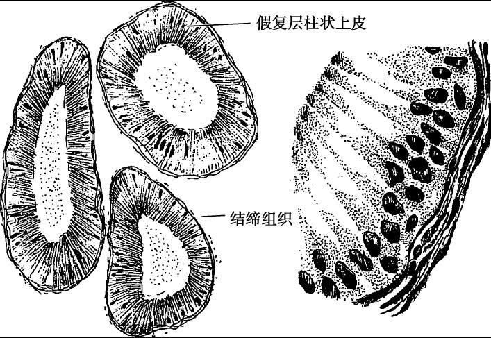 显微输精管和附睾手术_输精管和附睾的应用解剖_上海轶德医疗科技股份