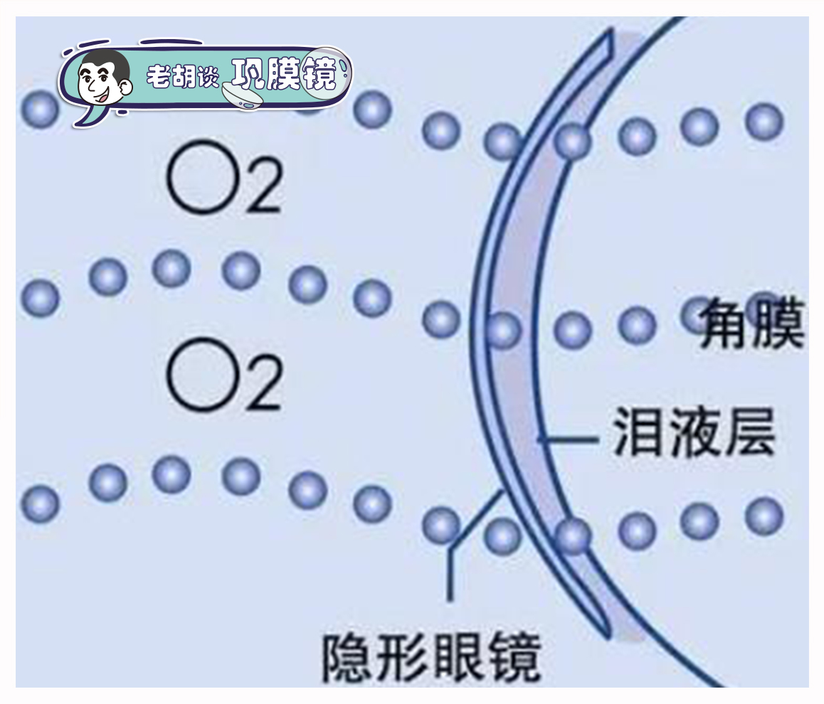 一分钟涨知识丨老胡谈巩膜镜—硬性接触镜的分类