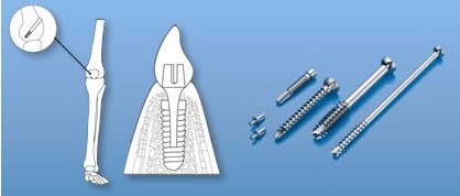 福涌機械：日本STAR走心機演變史——無錫福涌機械科技有限公司