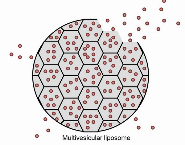 布比卡因脂質(zhì)體注射混懸液