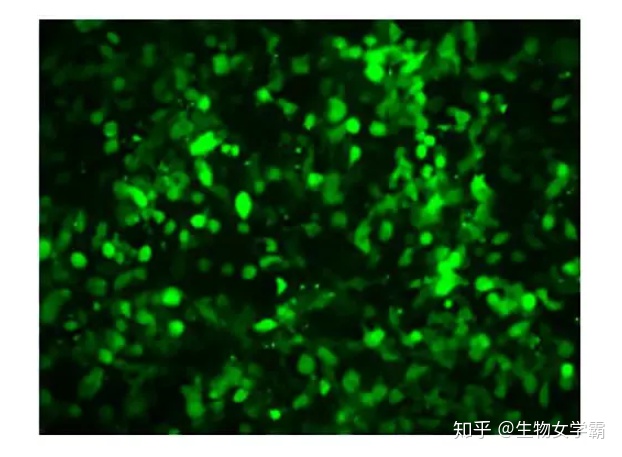 我們常說(shuō)脂質(zhì)體轉(zhuǎn)染，那么細(xì)胞轉(zhuǎn)染你了解多少呢？ -艾偉拓（上海）醫(yī)藥科技有限公司