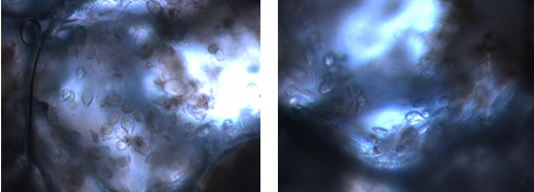 累枝蟲等微生物在載體大量繁殖