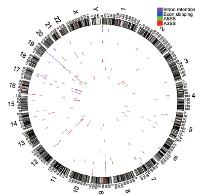 4个前列腺癌样品中的可变剪切事件的基因组图谱