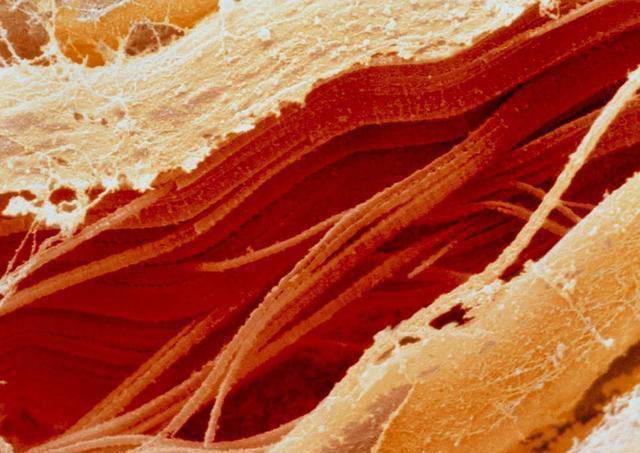 生肉玻片 生肉玻片