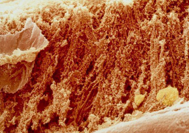 熟肉玻片 熟肉玻片