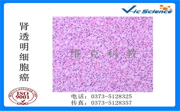 病理玻片 病理玻片