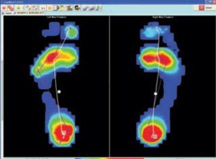 SPI Foottrax 足底壓力分布系統(tǒng)（平板式）