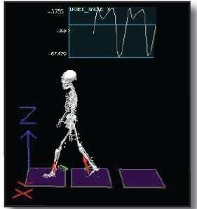步態(tài)分析系統(tǒng)